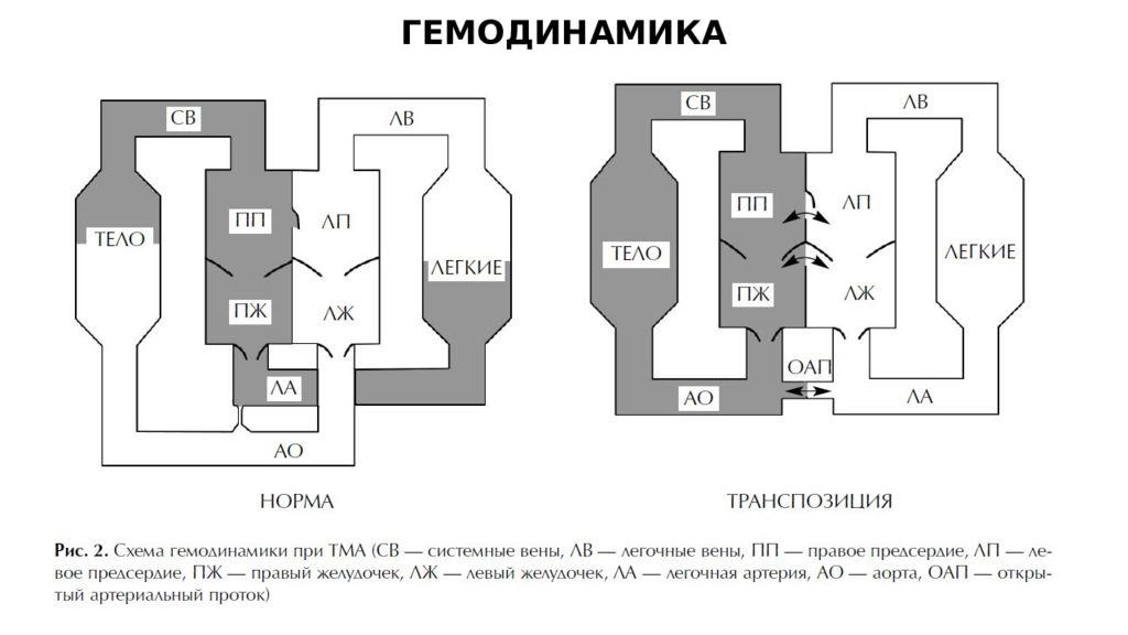 Крун к 112 схема