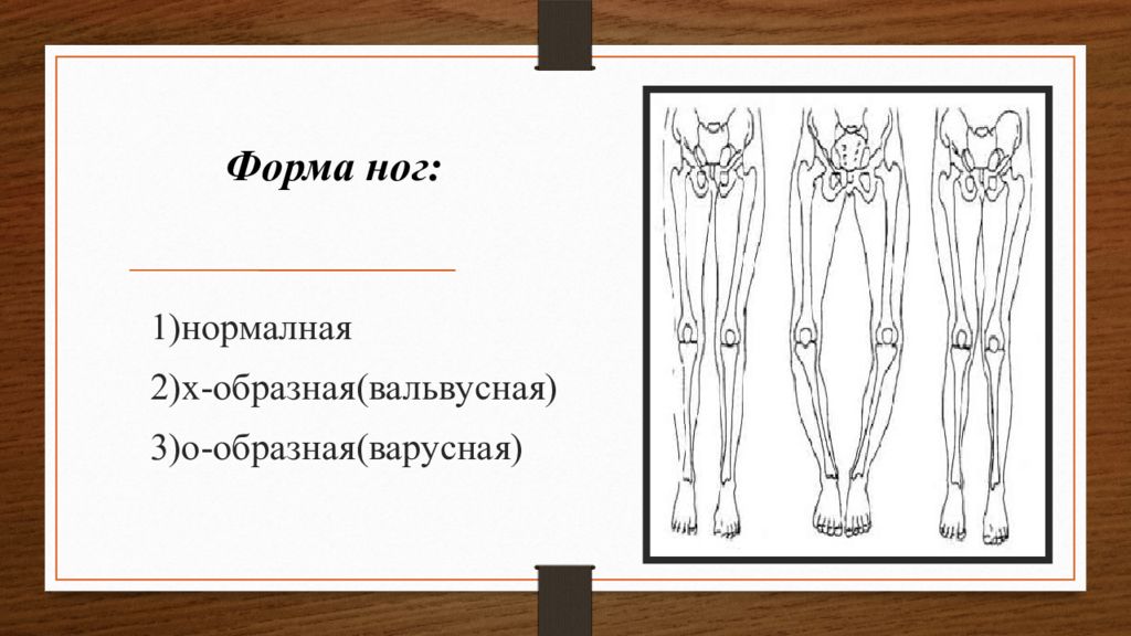 Формы ног. Форма ног. Оценка формы ног. Форма ног соматоскопия.