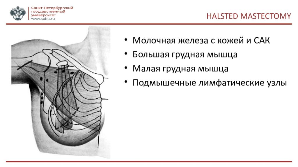 Хирургические заболевания молочной железы презентация