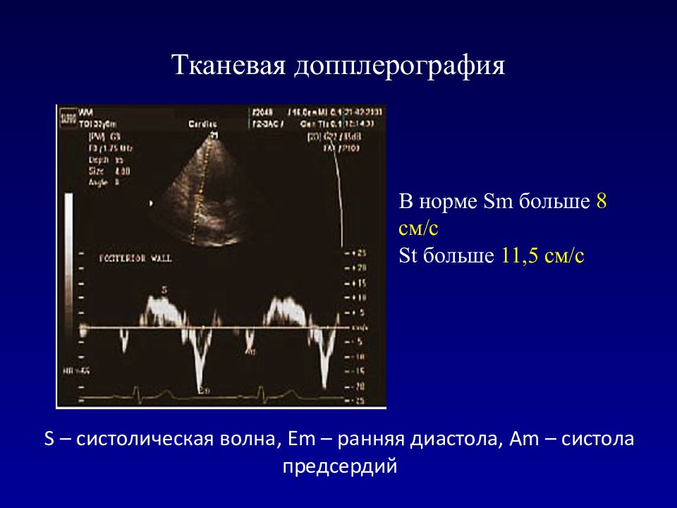 Эхокардиография сердца презентация