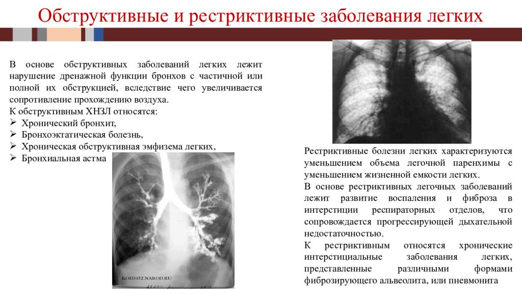 Туберкулез реферат