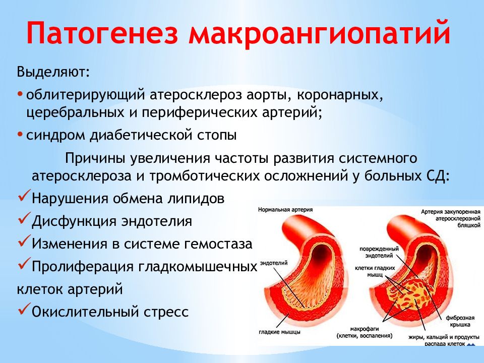 Диабетическая ангиопатия презентация