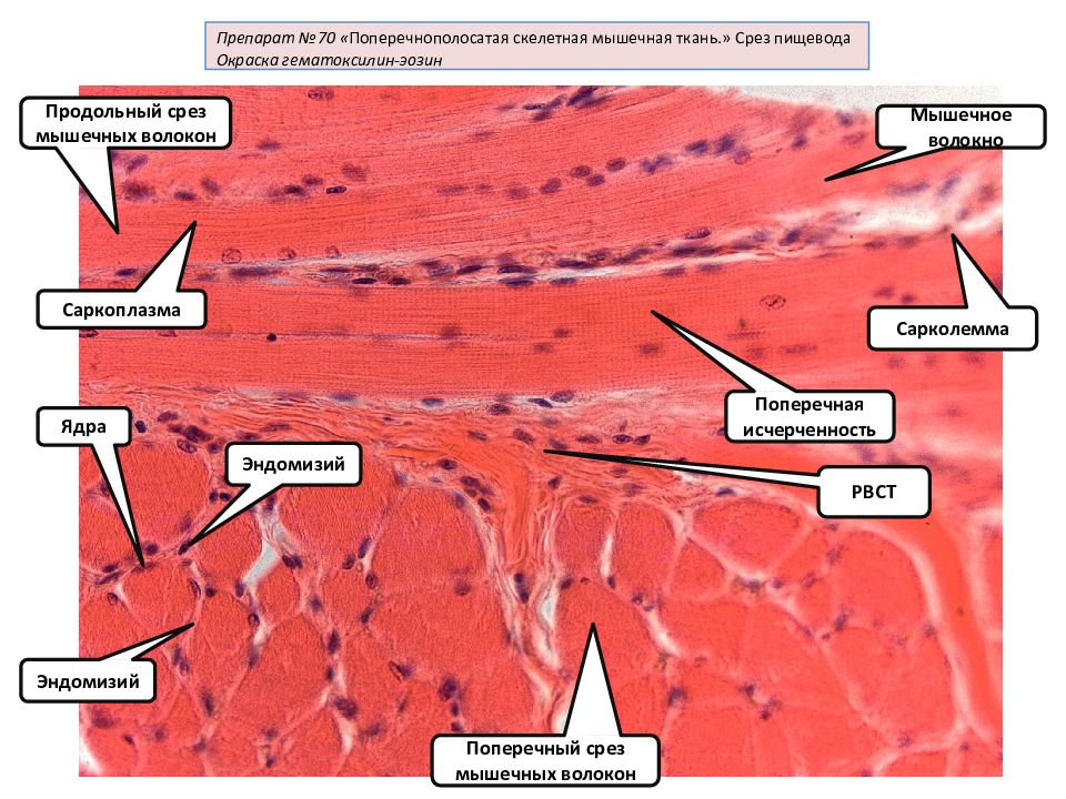 Поперечно полосатая сердечная мышечная ткань гистология рисунок