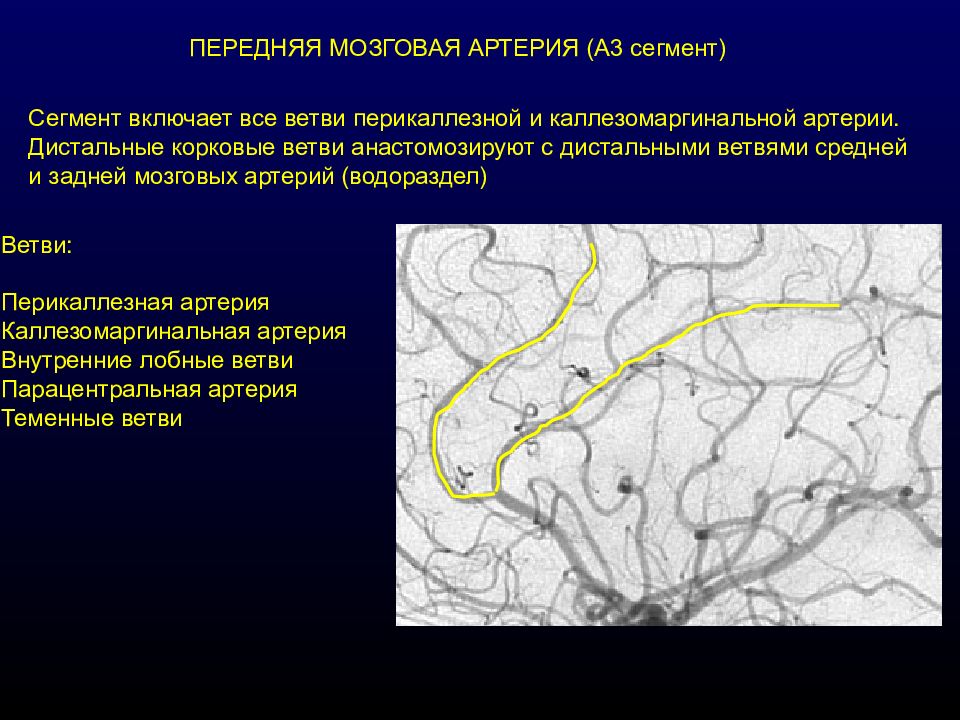 Сегмент а1 пма. М1 средней мозговой артерии. Сегменты м1 средней мозговой артерии головного мозга. Сегменты ПМА на кт. Передняя мозговая артерия сегмент а2.