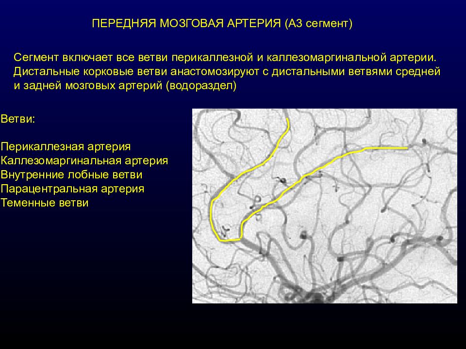 Сегмент артерии. М1 сегмент средней мозговой артерии. А1 сегмент передней мозговой артерии. Средняя мозговая артерия м1. М1 сегмент средней мозговой артерии схема.