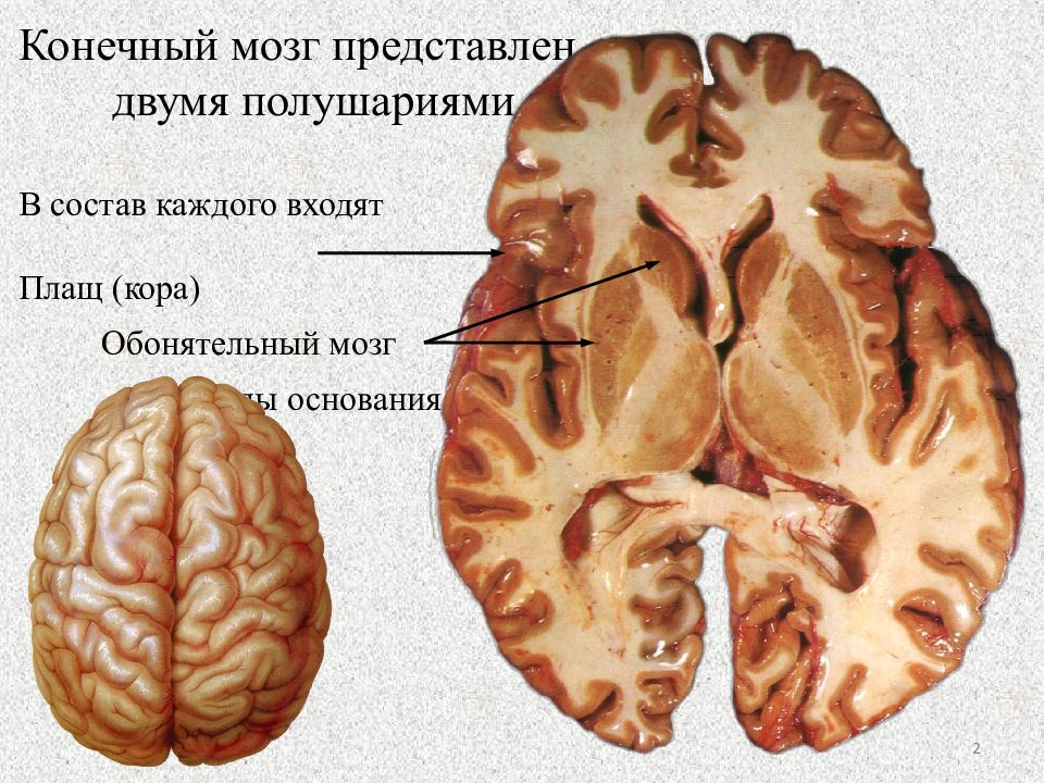 Полушария конечного мозга. Плащ анатомия конечный мозг. Конечный мозг обонятельный мозг. Плащ обонятельный мозг базальные ядра. Конечный мозг обонятельный мозг базальные ядра.