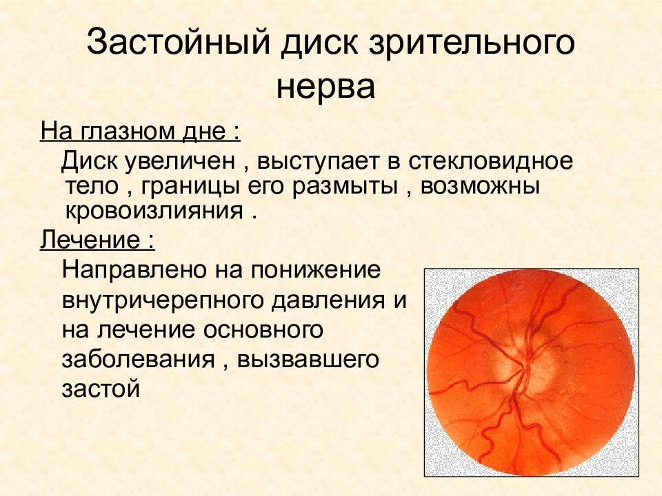 Заболевания сетчатки и зрительного нерва офтальмология презентация