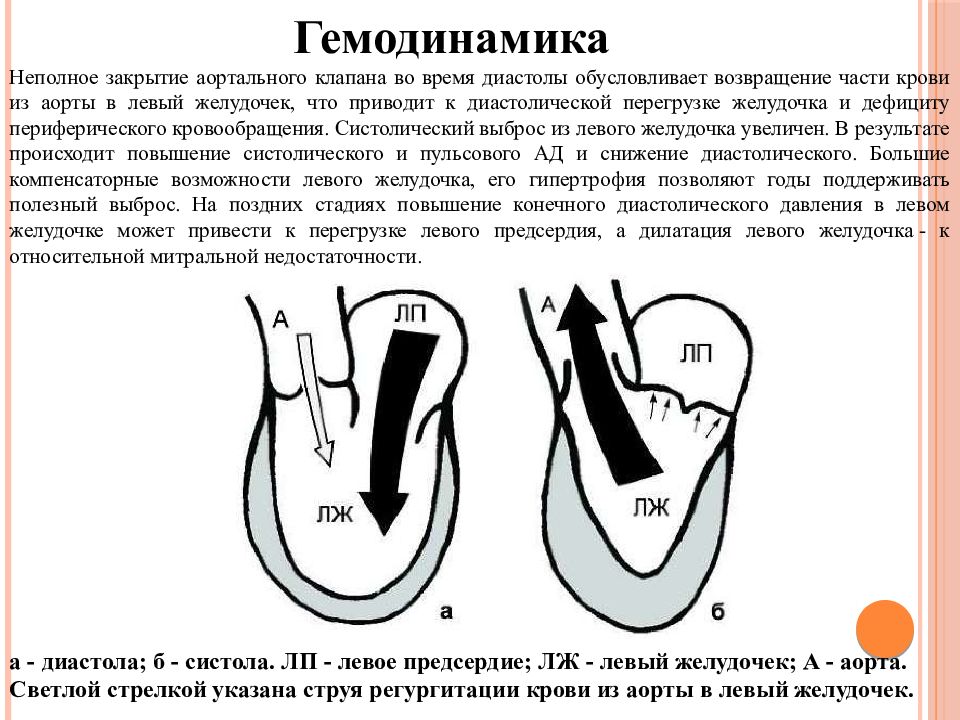 Нарушение гемодинамики 1а степени при беременности