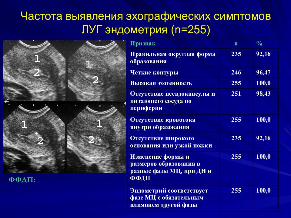 Эндометрия 16 мм. Структура эндометрия на УЗИ. Структура эндометрия неоднородная. Фазы эндометрия по УЗИ.