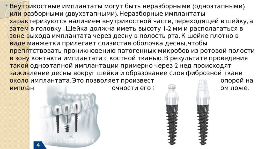 Особенности протезирования с использованием различных систем имплантатов презентация