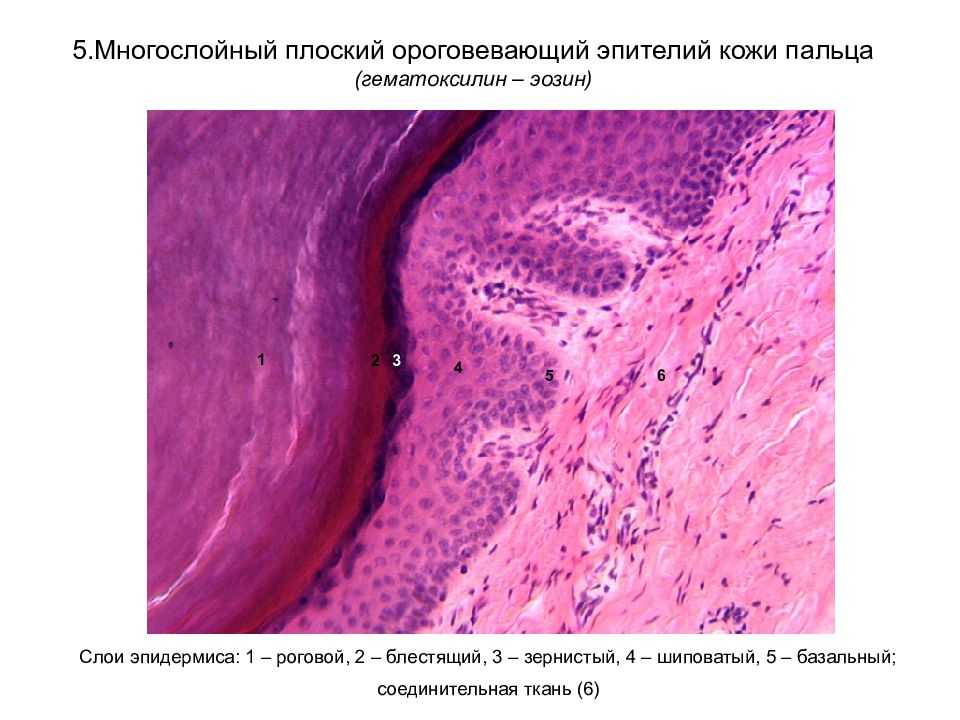 Многослойный плоский ороговевающий эпителий кожи пальца рисунок
