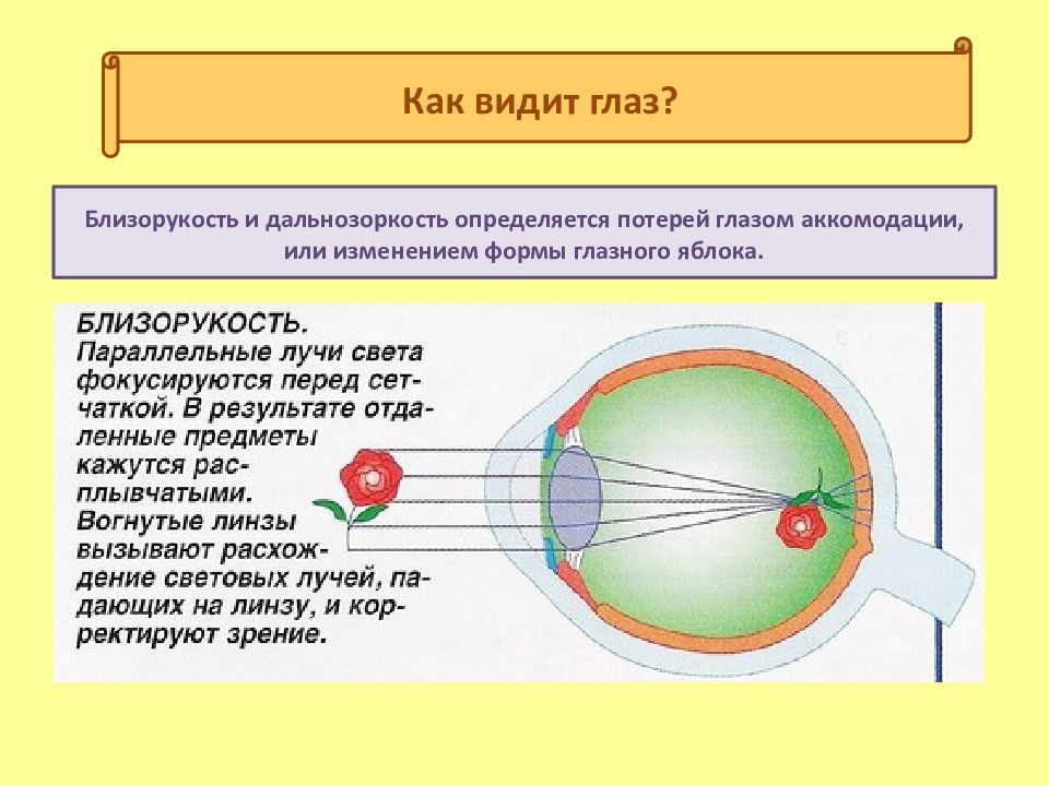 Почему видит глаз. Дальнозоркость форма глазного яблока. Как видит глаз. Строение глаза дальнозоркость. Глаз дальнозоркость и близорукость.