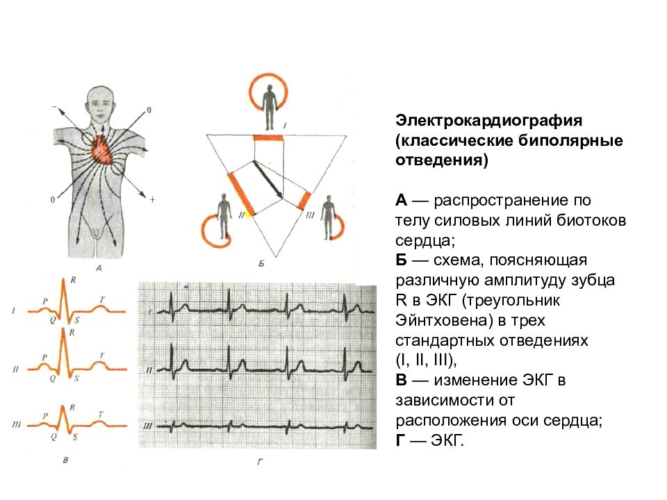 Отведения экг. 3 Стандартное отведение ЭКГ. Стандартные отведения ЭКГ электроды.