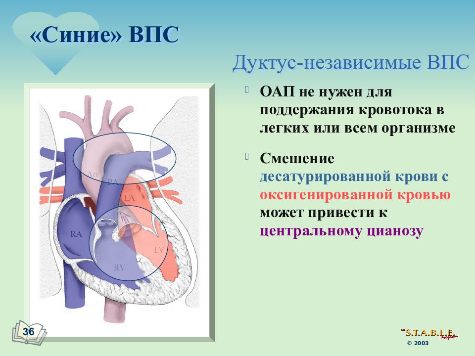 Белые пороки сердца у детей презентация