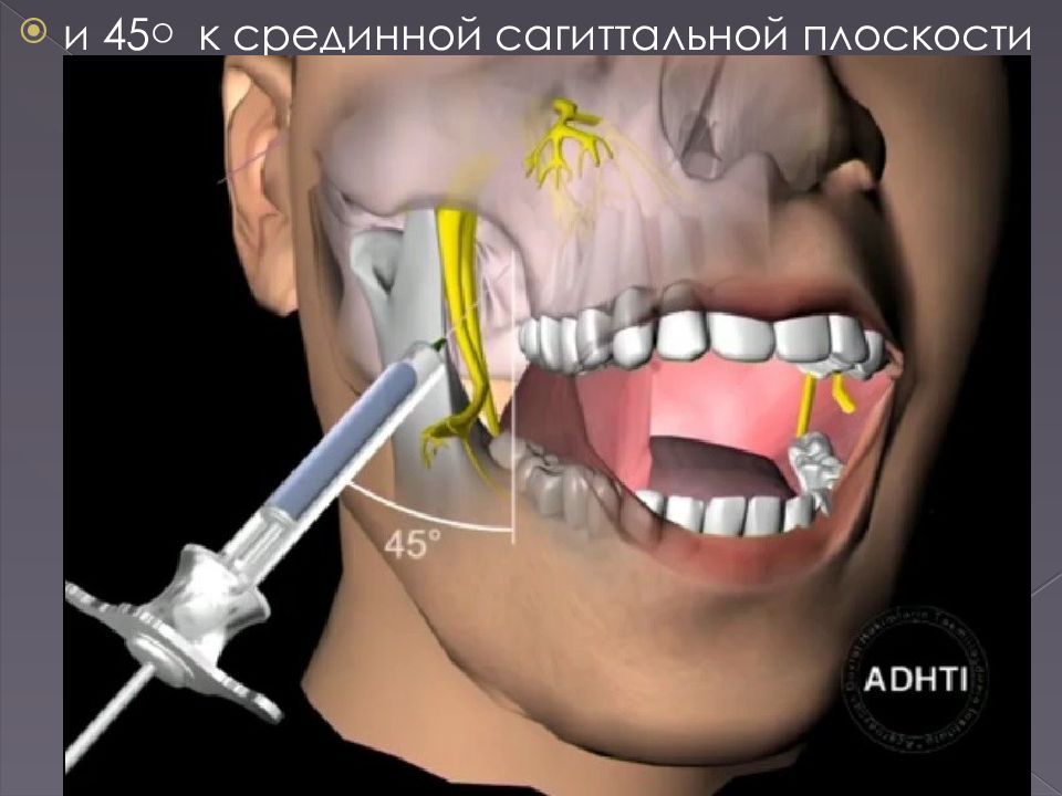 Презентация анестетики в стоматологии