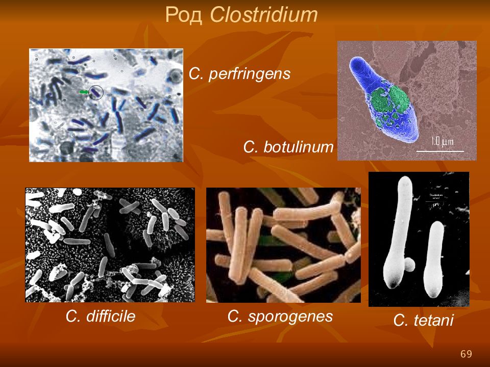 Кластридии. Патогенные клостридии перфрингенс. Clostridium botulinum жгутики. Бациллы и клостридии. Клостридии бактерии.