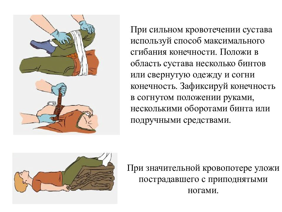 Оказание первой помощи при ранениях и кровотечениях презентация