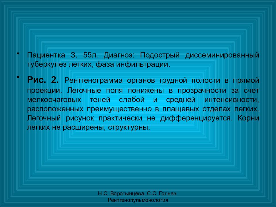 Туберкулез легких в фазе инфильтрации. Диссеминированный инфильтративный туберкулез. Диссеминированный туберкулез в фазе инфильтрации. Диссеминированный туберкулёз лёгких в фазе инфильтрации МБТ. Диссеминированный туберкулез в фазе распада.