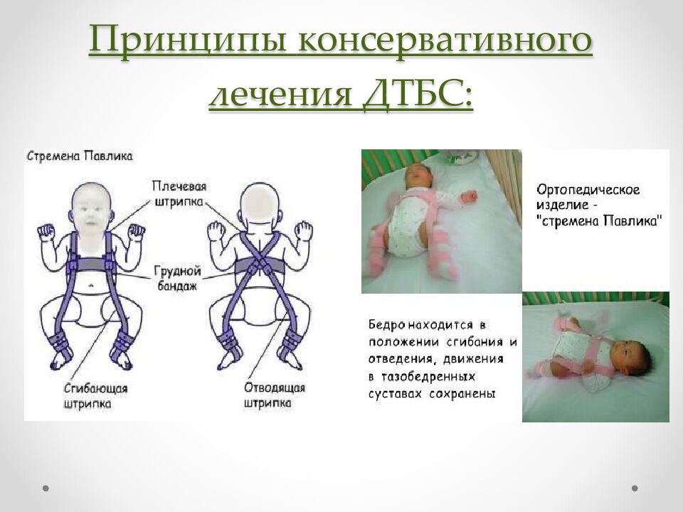 Принципы консервативного лечения ДТБС: