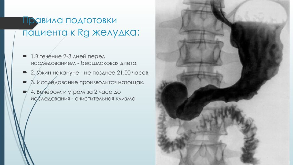 Перед обследованием желудка. Рентгенологическое исследование желудка. Обследования кишечника ирригоскопия. Подготовка к исследованию ирригоскопии. Ирригоскопия памятка.