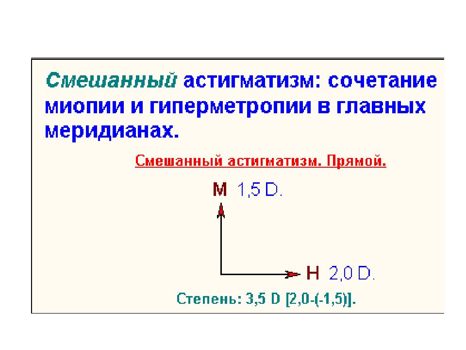 Презентация аномалии рефракции