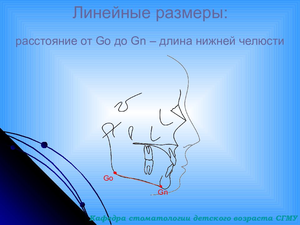 Точка me. Точки ТРГ В ортодонтии. Точка sna на ТРГ. Межрезцовый угол ТРГ. Точки и углы в ортодонтии.