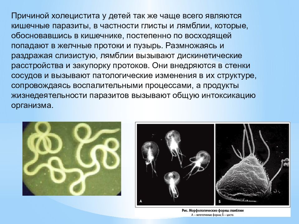 Лямблии в печени картинки