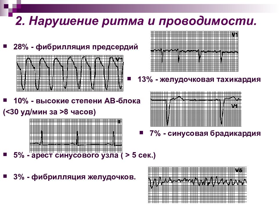 Брадикардия карта вызова