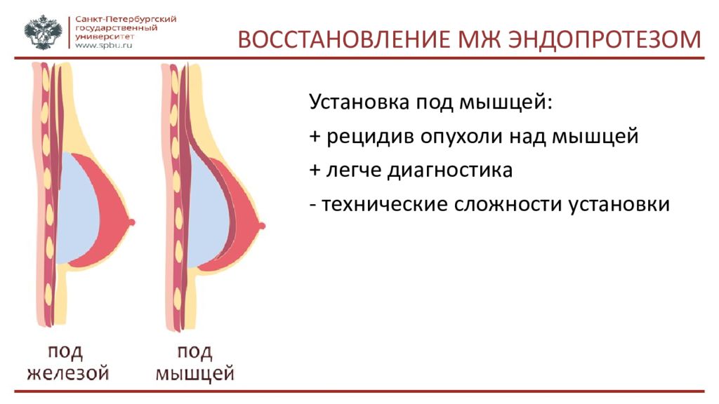 Рецидив после антибиотиков