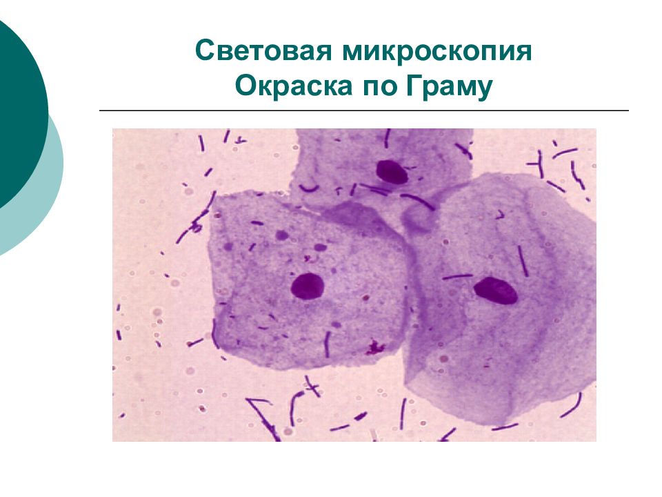 Световая микроскопия. Световая микроскопия окраска по Граму. Световая микроскопия препараты. Световой микроскоп микробиология.