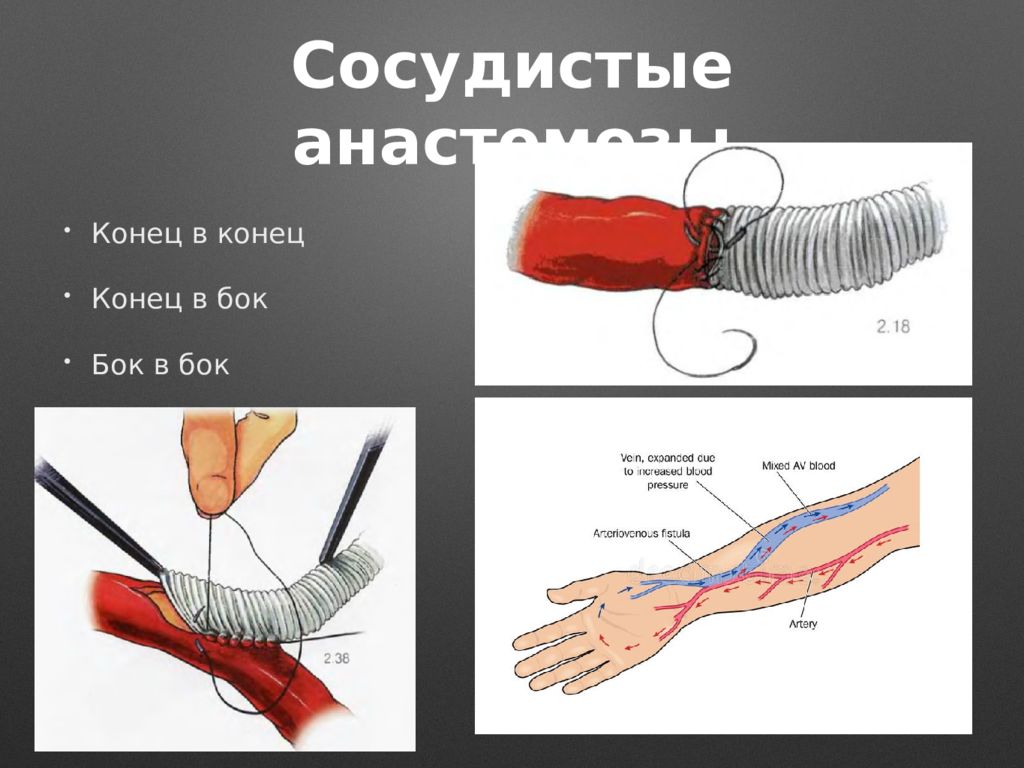 Нарушение кровообращения хирургия презентация