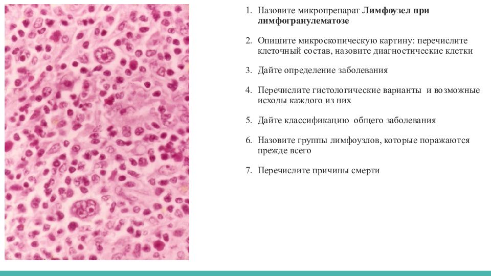 Описание микропрепарата. Лимфатический узел при лимфоме Ходжкина микропрепарат. Лимфогранулематоз лимфатического узла микропрепарат описание. Лимфома Ходжкина микропрепарат. Лимфатические узлы при лимфогранулёматозе макропрепарат.