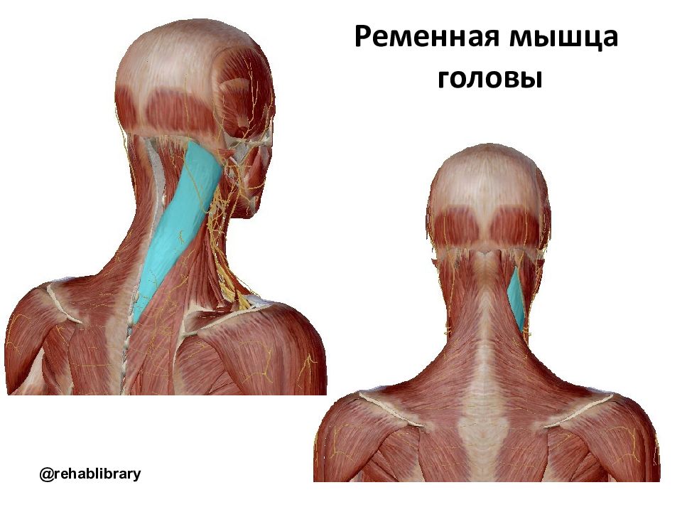 Часть шеи ниже затылка. Ременная мышца головы и шеи. Ременная мышца головы. Ременная мышца шеи.