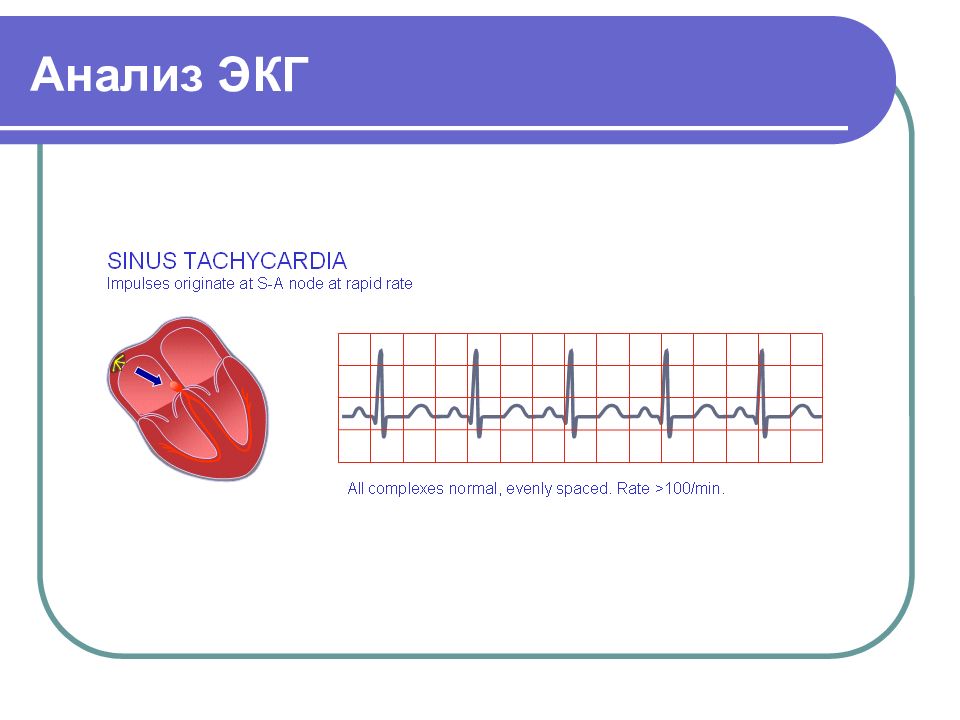 Основы экг презентация