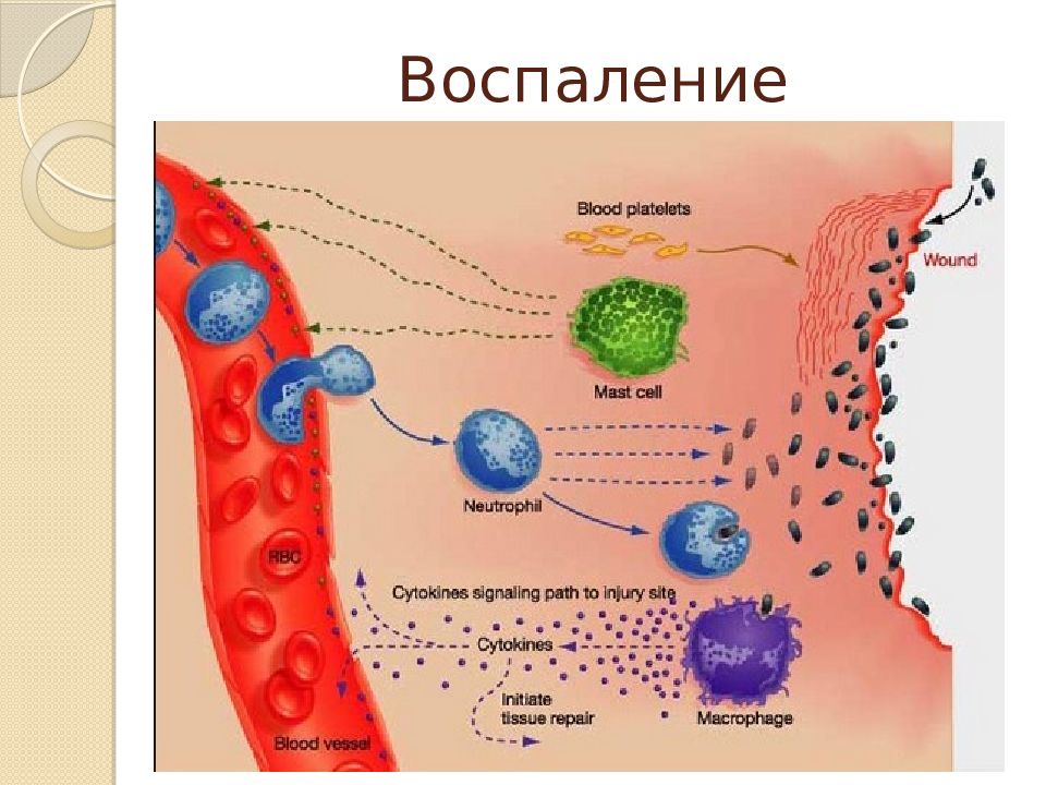 Воспаление картинки для презентации