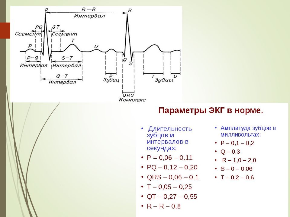 Нормальное экг презентация