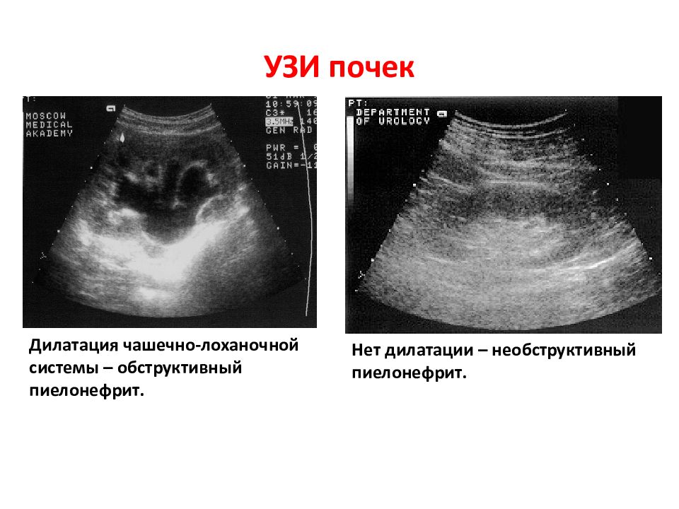 Узи почек картинки для презентации