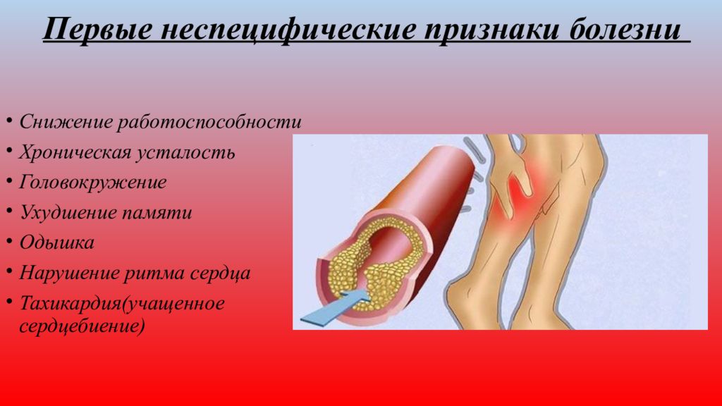 Атеросклерозом чаще поражаются. Атеросклероз презентация. Локализация атеросклероза. Клинические проявления атеросклероза.