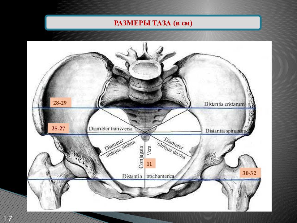 Акушерские размеры таза на рисунке