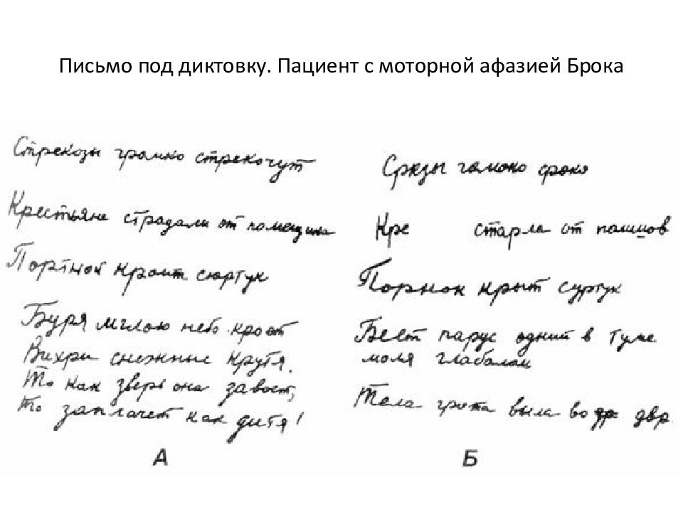 Афазия письмо. Письмо под диктовку больного с афферентной моторной афазией. Письмо больному. Письмо под диктовку. Письмо пациенту.