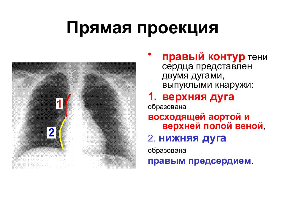 Прямая проекция рентгенограмма. Дуги сердца на рентгенограмме в прямой проекции. Дуги правого контура сердца в норме. Прямая проекция сердца. Тень сердца на рентгенограмме в норме.