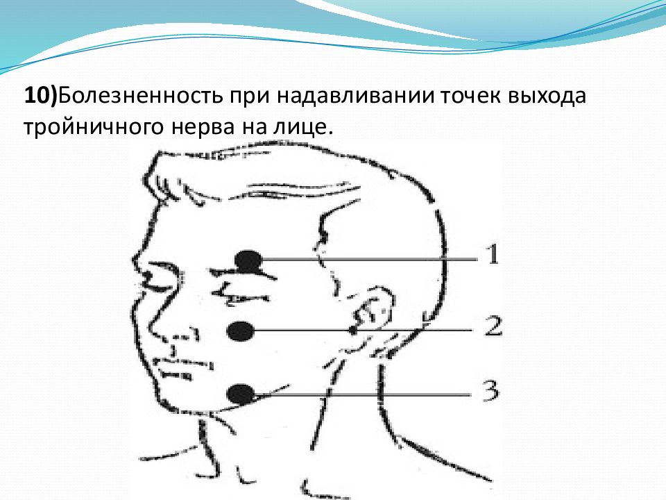 Точки выхода. Точки Валле тройничного нерва. Болевые точки тройничного нерва. Пальпация точек выхода ветвей тройничного нерва. Точки пальпации тройничного нерва на лице.