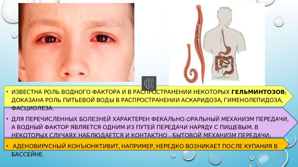 Роль воды в распространении. Роль воды в распространении инфекционных. Роль водного фактора в распространении инфекционных заболеваний. Роль воды в распространении инфекционных заболеваний. Гименолепидоз презентация инфекционные болезни.