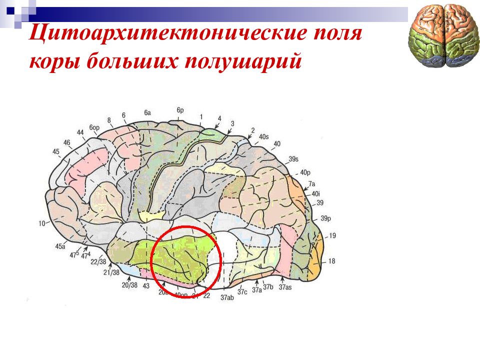 Сенсорные слуховые расстройства презентация