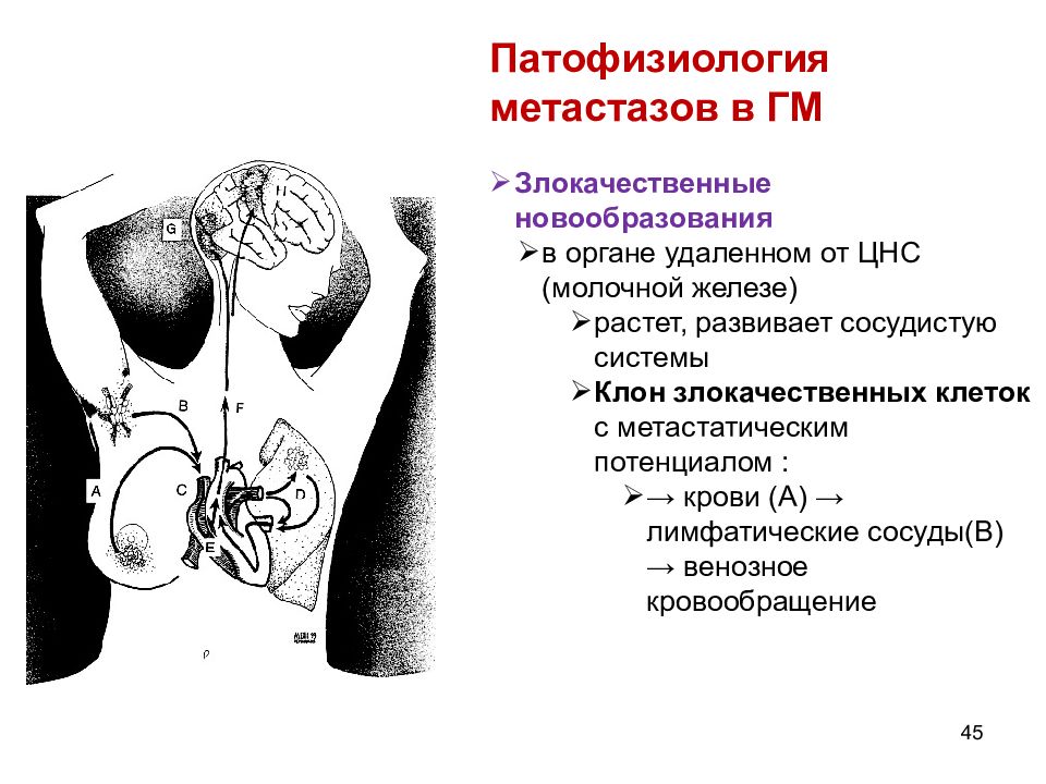 Опухоли цнс презентация