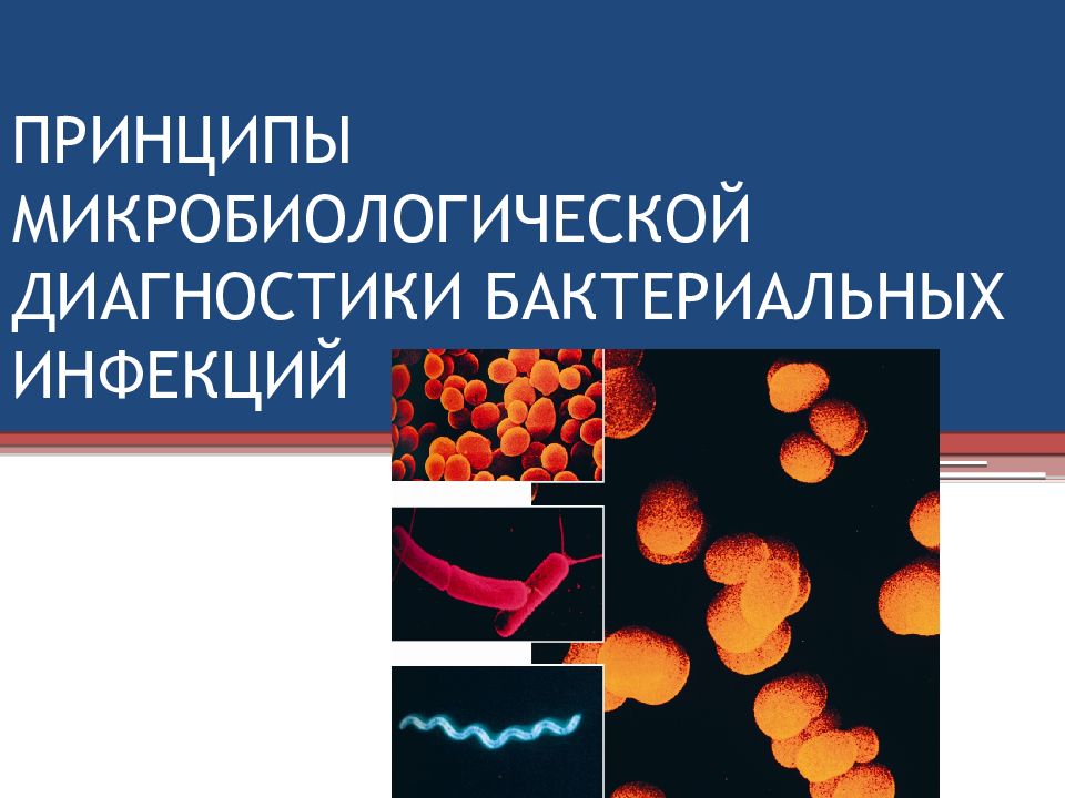 Общая схема лабораторной диагностики инфекционных заболеваний бактериальной этиологии