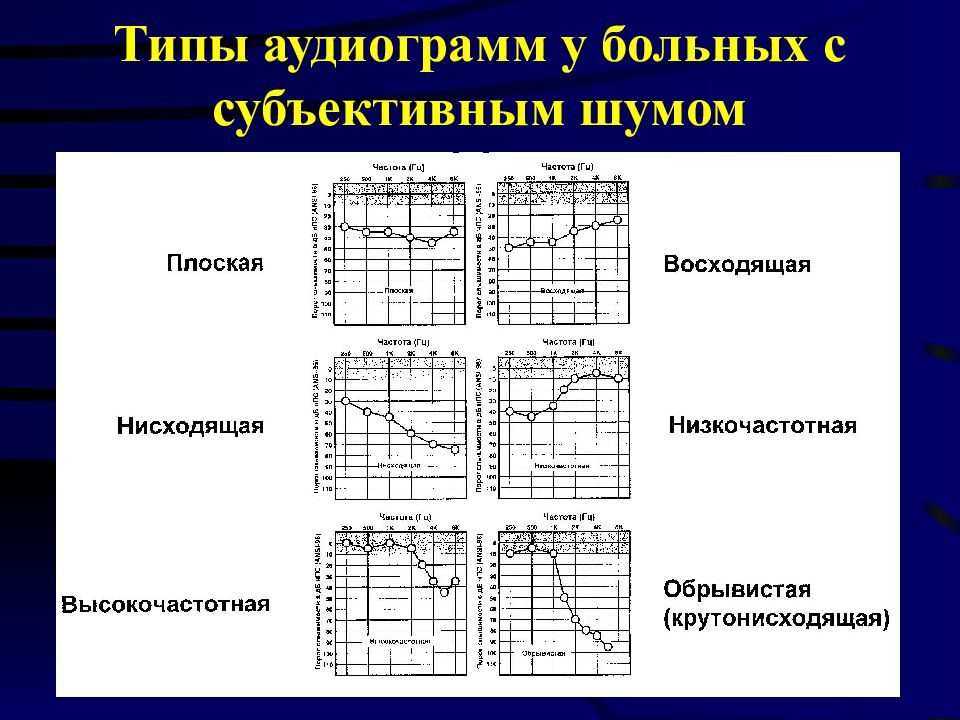 Аудиограмма слуха что это