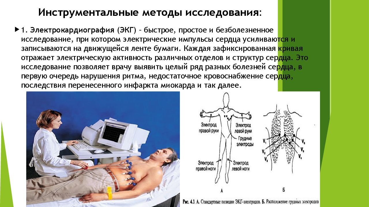 В каких условиях необходимо проводить исследование экг