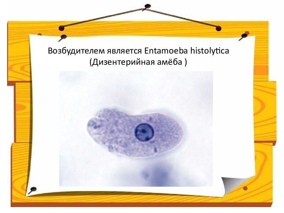 Презентация амебиаз микробиология