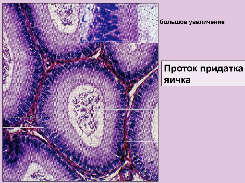 Увеличение крупный. Придаток яичка гистология препарат. Строение придатка яичка гистология. Придаток яичка гистология. Проток придатка яичка гистология.